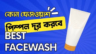 ১ মিনিটে ধ্বংস হবে সকল জীবাণু তাও আবার কার্বন ফেসওয়াশ দিয়ে।কার্বন ফেসওয়াশ