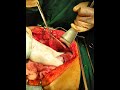 video thumbnail (9)