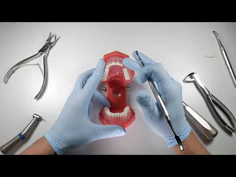 How To Manage A Broken Buccal Plate During An Extraction