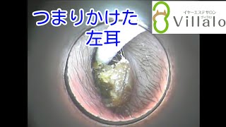 耳掃除動画vol.59「つまりかけた左耳」