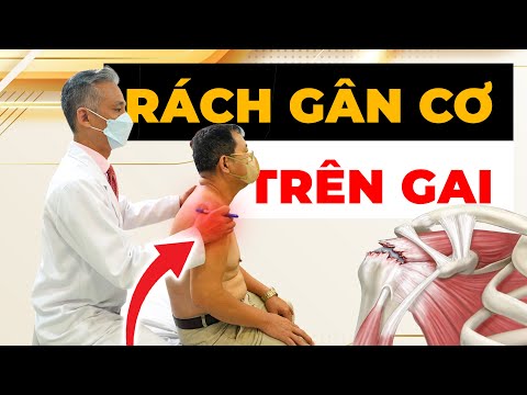 Đau vai khi nâng tay - Dấu hiệu NGUY HIỂM của rách gân cơ trên gai