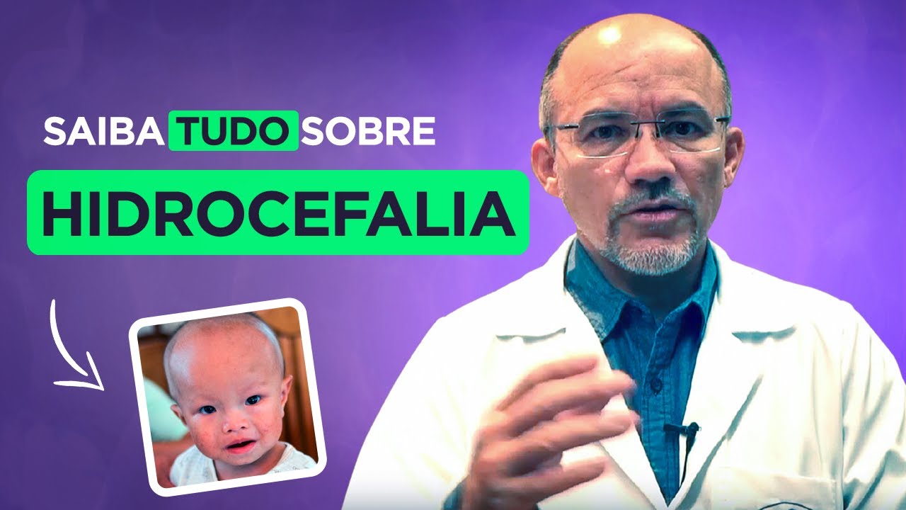 Hidrocefalia: Sintomas, Tratamentos e Muito Mais