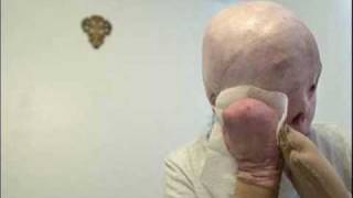 JAQUELINE UMA LIÇÃO DE VIDA