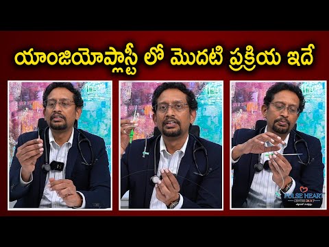 Coronary Artery Angioplasty Explained Step by Step (Radial Access & Femoral Access)