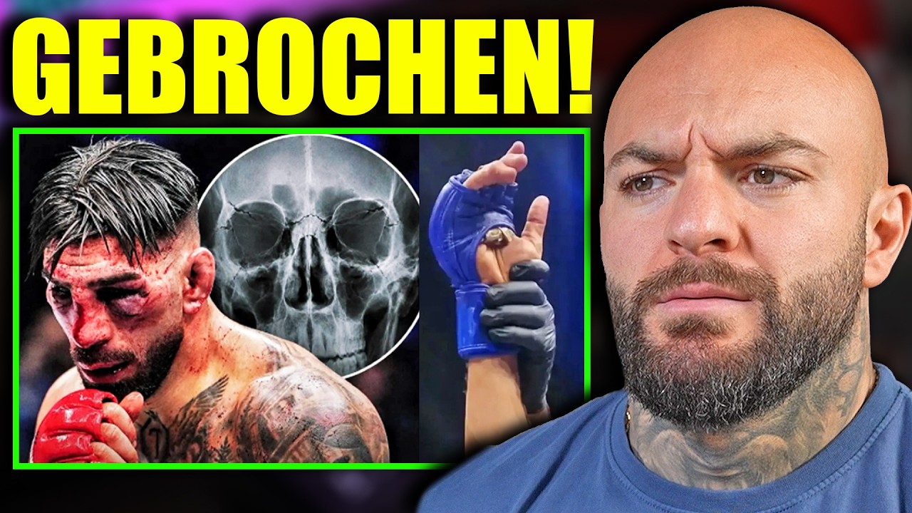 Gesicht gebrochen durch MANIPULIERTE Handschuhe? Topuria Statement nach Kampf - RINGLIFE