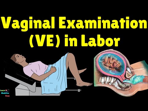 Vaginal Examination (VE) in Labor | Pelvic Exam During Pregnancy - Maternal Care - Obstetrics