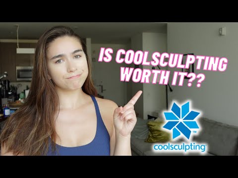 Was Coolsculpting worth it? Before and after results