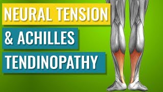 How Neural Tension can Cause Achilles Tendinopathy