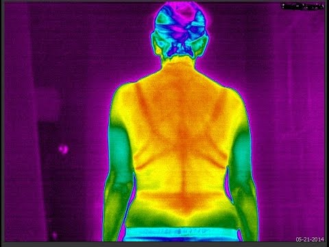 Medical Thermography Training