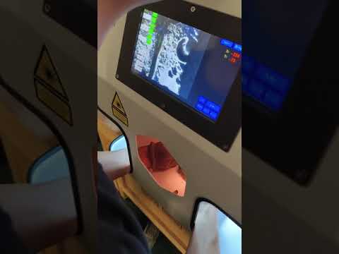 ABP Laser ürün videosu 1