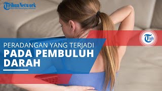 Mengenal Vaskulitis, Peradangan Pembuluh Darah yang Menyebabkan Perubahan Dinding Pembuluh