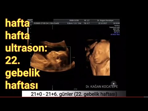 22. haftada anne karnında açıklamalı ultrason görüntüleri (rahim ağzı ölçümü,renkli Doppler,omurga)