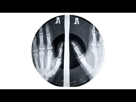 APOC KRYSIS - PERFECT MATCH (DJ DEADHORSES ACID JUNGLE MIX)