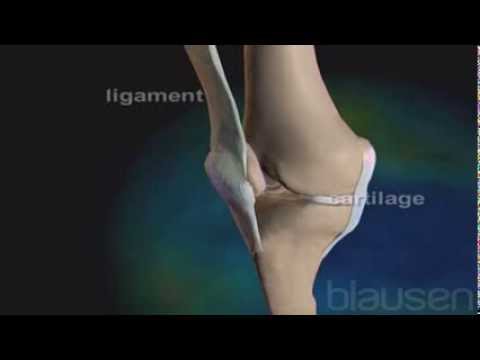 comment soulager menisque