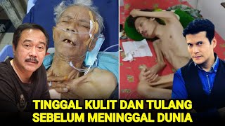 Download lagu Sangat Miris, Tubuh 7 Artis Ini HanyaTinggal Kulit Dan Tulang Sebelum Meninggal Dunia mp3 Download lagu Sangat Miris, Tubuh 7 Artis Ini HanyaTinggal Kulit Dan Tulang Sebelum Meninggal Dunia mp3