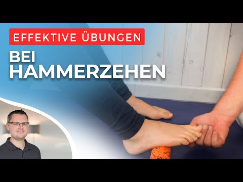 Fußballspecial: Hammerzehen- Woher er kommt und was Du dann machst