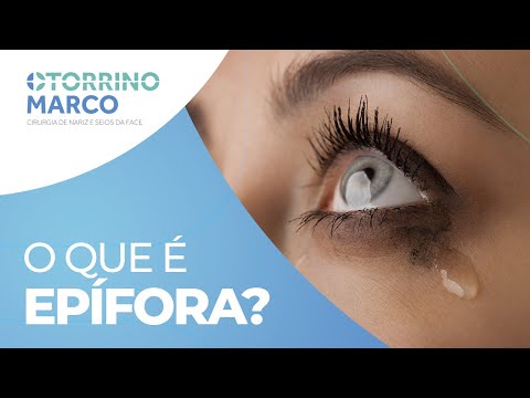 Lacrimejamento Excessivo e Involuntário? Epífora e a Desobstrução de Vias Lacrimais - Otorrino Marco