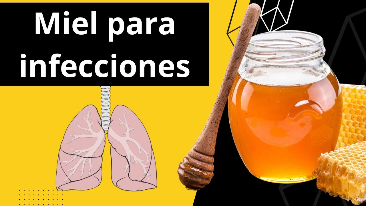 ¿Es la miel el mejor remedio para infecciones de vías respiratorias y de garganta