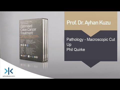 3.3.4. Pathology - Macroscopic Cut Up - Phil Quirke