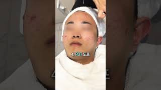 피부 재생에 효과적인 PDT 패키지