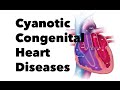 Cyanotic Congenital Heart Diseases - MEDZCOOL
