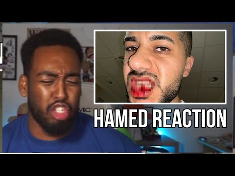 FARO REACTS to HAMED'S BROKEN JAW❤‍🩹😭