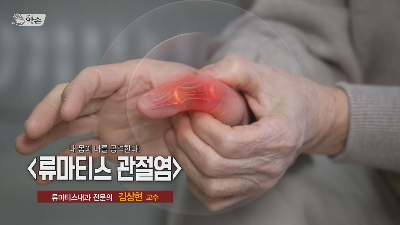 류마티스 관절염, 모든 장기에 영향을 미치다 ㅣ 류마티스내과 김상현 교수 관련사진