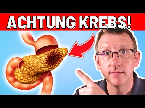 10 Frühwarnzeichen von Bauchspeicheldrüsenkrebs, die sofortiges Handeln erfordern!