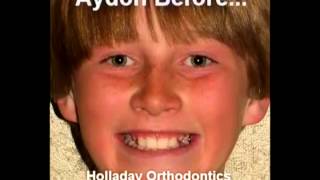 preview picture of video 'Orthodontist Salt Lake City UT Call (801) 278-7272'
