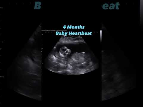 4 Months Baby Heartbeat 💗 #jerbearimaging #heartbeat #heart #sono #inhomeultrasound