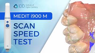 Medit i900 Mobility Speed Test - How Fast Is iPad Scanning? | iDD