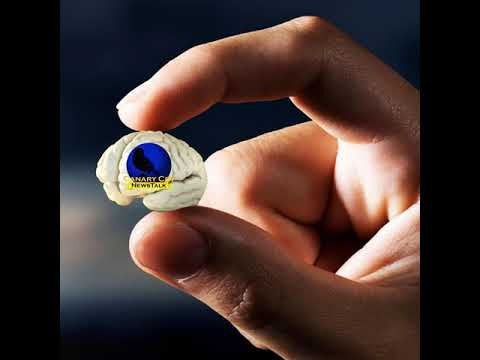 CCNT “Mini-Brain’s & Bio-hacked to Death” - 06.27.2018