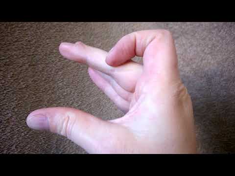 Der Frosch ist traurig