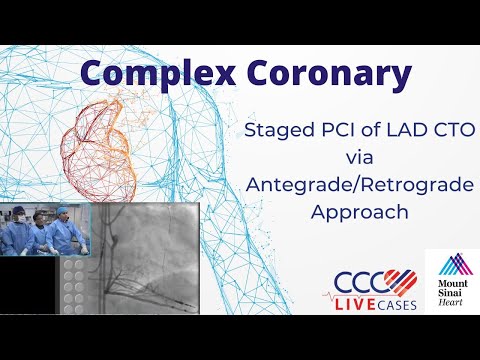 Staged PCI of LAD CTO via Antegrade/Retrograde Approach - January 19th, 2016  Webcast
