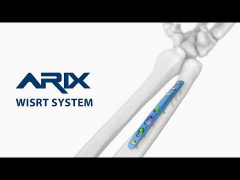 [ARIX OS] ARIX Ulna Osteotomy System