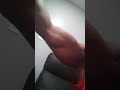 Huge Muscle Cramp in Triceps!!!