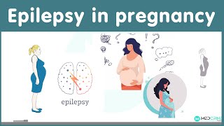 Epilepsy in pregnancy: Causes, Risks and management