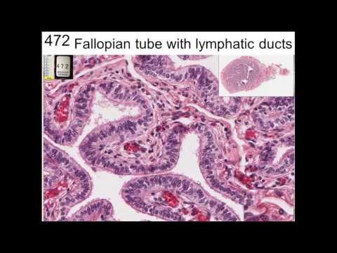 23. Female Reproductive System