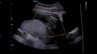 Violet in Clare ultrasounds to Cleo by Built to Spill