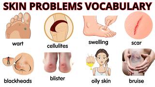 Skin Problems Vocabulary in English | Learn Common Skin Conditions with Meanings and Examples
