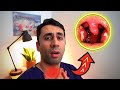 What Causes a Sore Throat? HOME Remedies and Cures for Fast TREATMENT| Doctor Explains