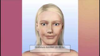 SilkPeel Dermal Infusion