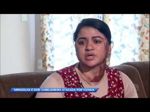 Mulher fica irreconhecível após ser atacada pela vizinha com óleo quente