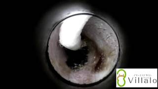 耳掃除動画　vol.1「黒い耳垢」