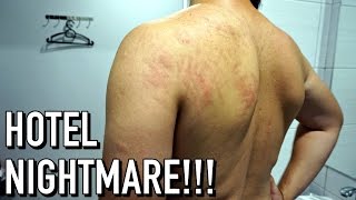 KUALA LUMPUR HOTEL NIGHTMARE - BED BUG INFESTATION! | Sasana Hotel Petaling Street KL