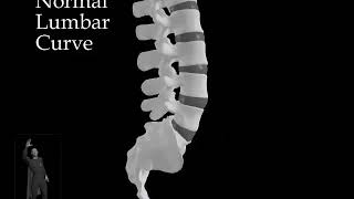 Normal Lumbar Curve