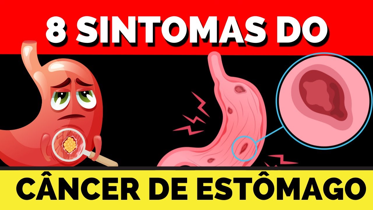 8 sintomas do câncer de estômago