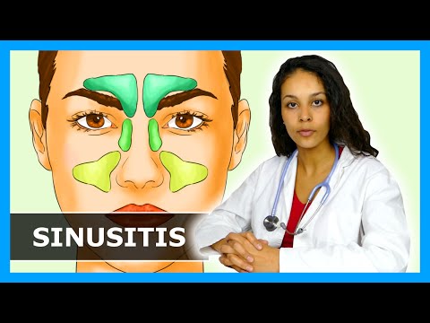 SCHNUPFEN, KOPFSCHMERZEN & Co. - NASENNEBENHÖHLENENTZÜNDUNG loswerden - Tipps & Hausmittel