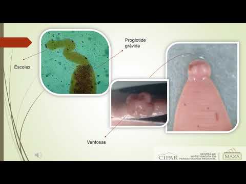 condiloame externe intraductal papilloma left untreated
