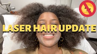 QUICK Laser Hair Removal Update: Chin, Jaw, Upper Lip (Laser Hair Removal on Dark Skin)